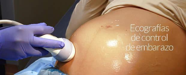 ecografias control del embarazo atocha 1